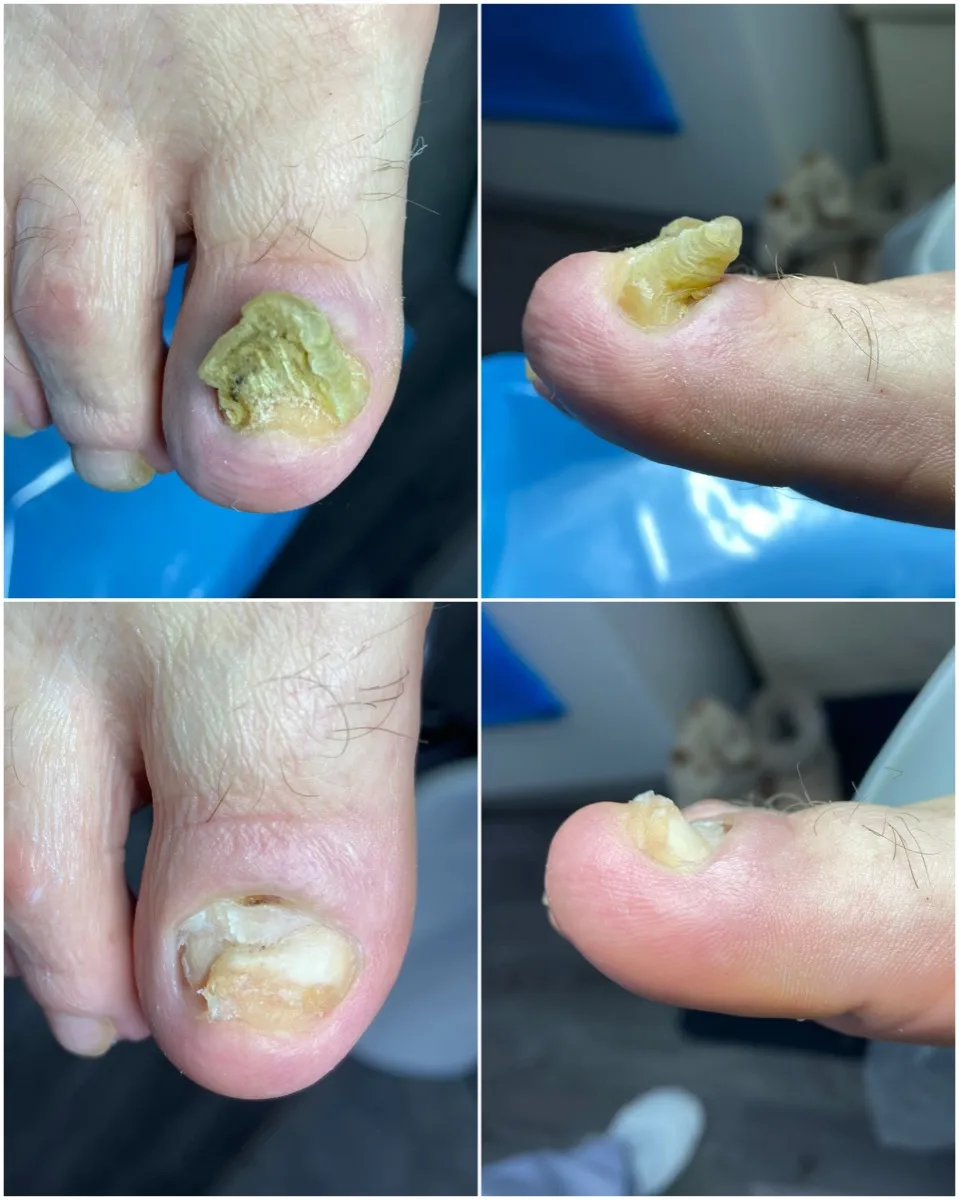 Результат роботи подолога - Деформації та травми