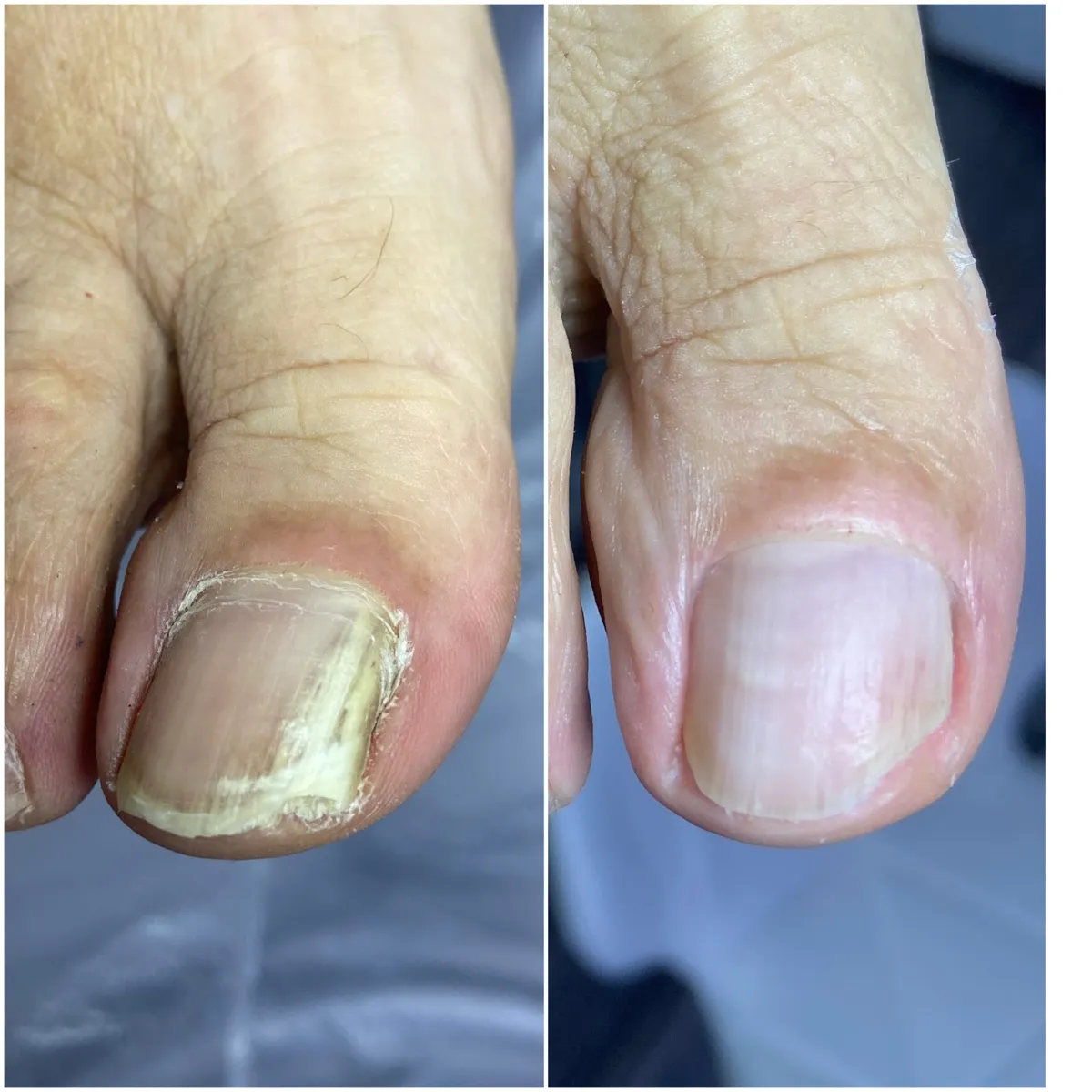 Результат роботи подолога - Консультація