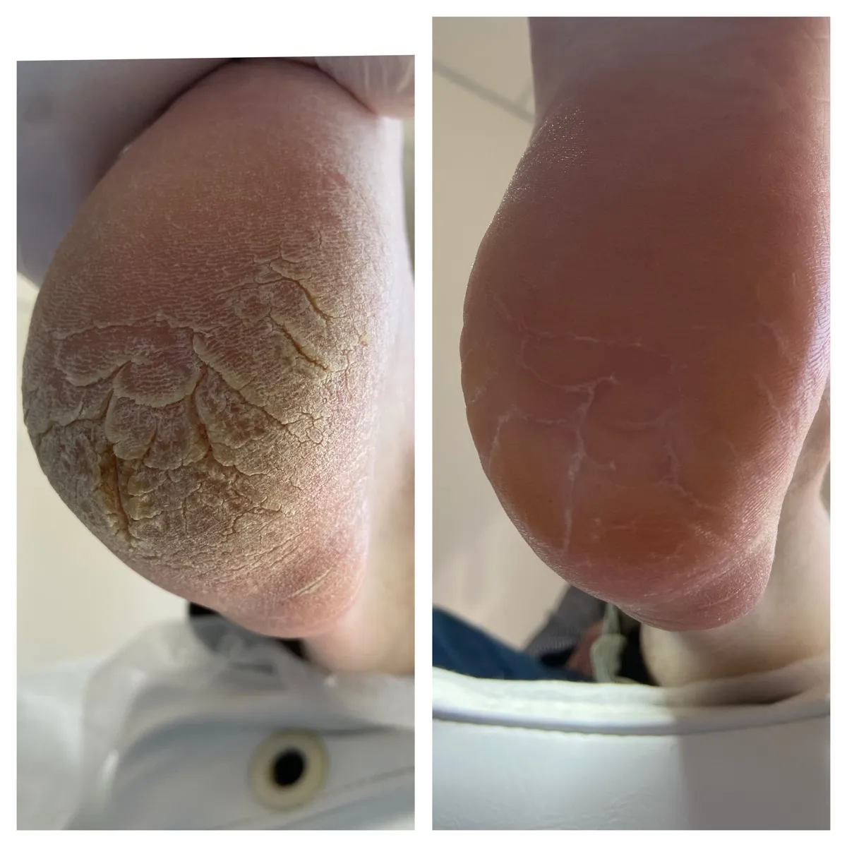 Результат роботи подолога - Консультація