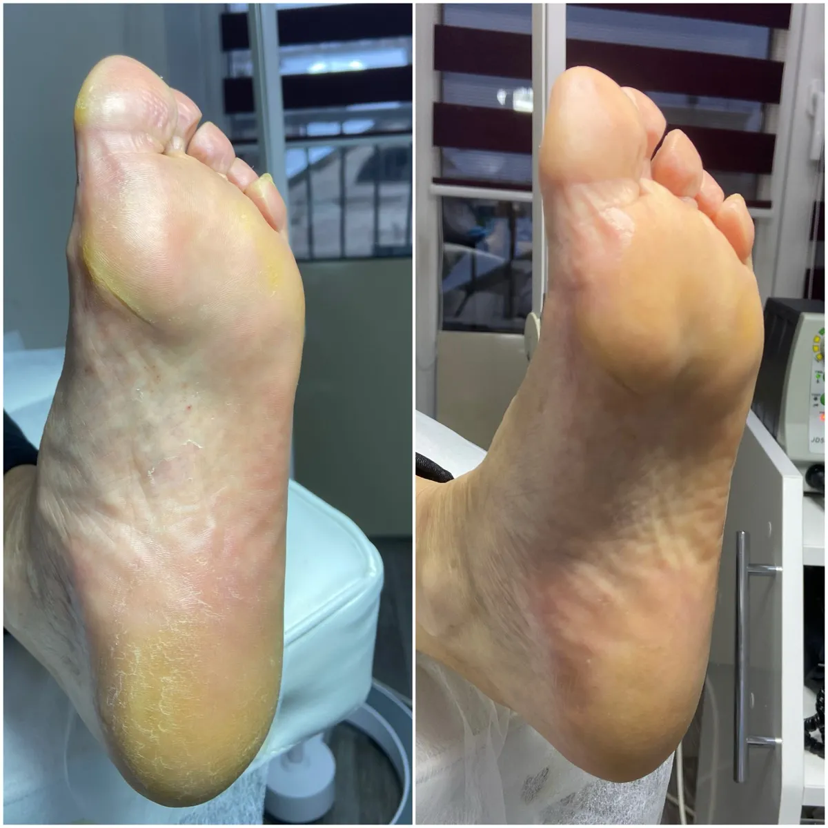 Результат роботи подолога - Консультація