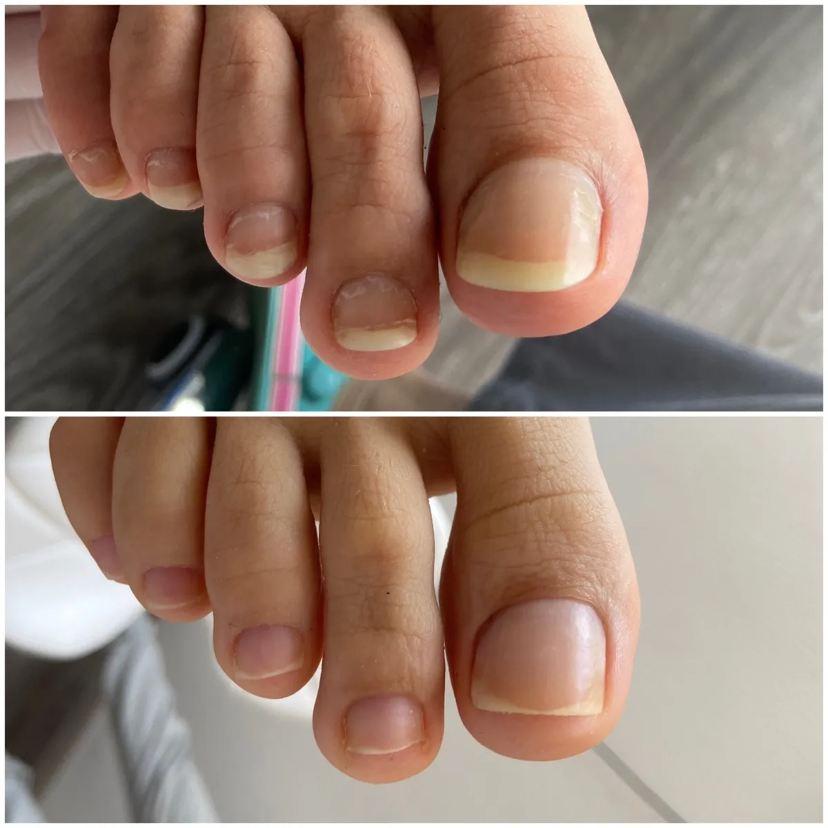 Результат роботи подолога - Консультація