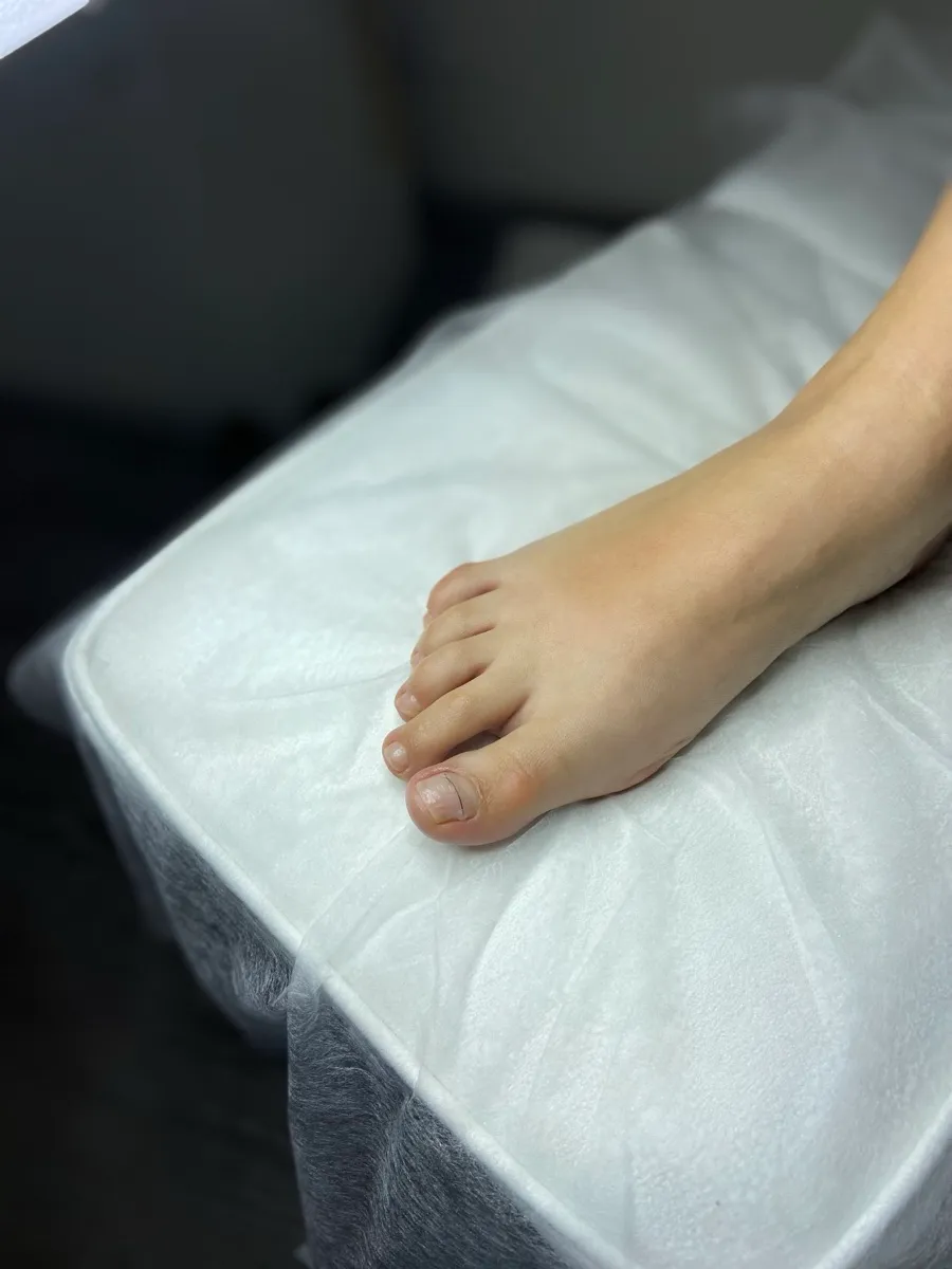 Результат роботи подолога - Апаратний педикюр